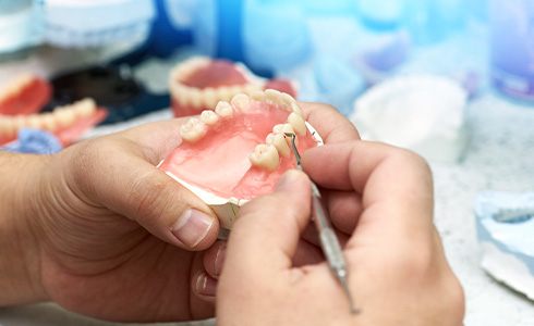 The denture manufacturing process is a fascinating multi-step process