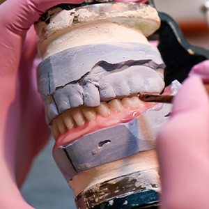 The denture creation process is done in about nine steps
