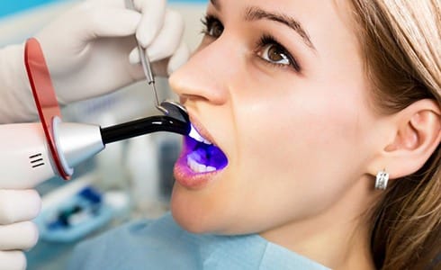 woman getting dental bonding hardened with curing light 