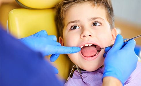 Child receiving dental sealants