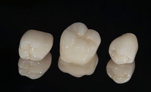 three dental crowns against black background
