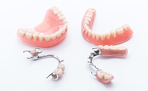 Four types of dentures