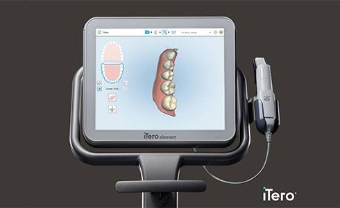 iTero digital impressions on computer screen