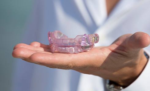 Oral appliance for sleep apnea treatment