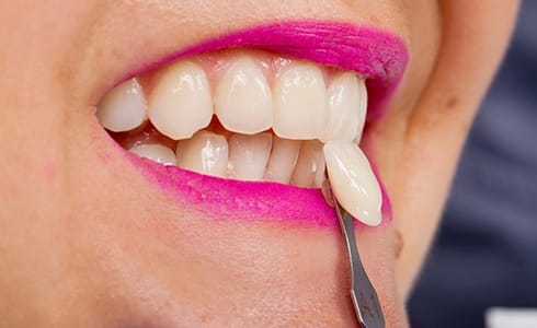 Woman at consultation for veneers in Oklahoma City.