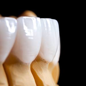 Close up of model of white teeth