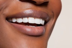 Close-up of a woman smiling and showing her teeth